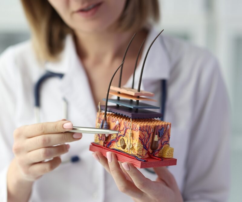 Primo piano di una dermatologa che tiene un modello artificiale di pelle umana.