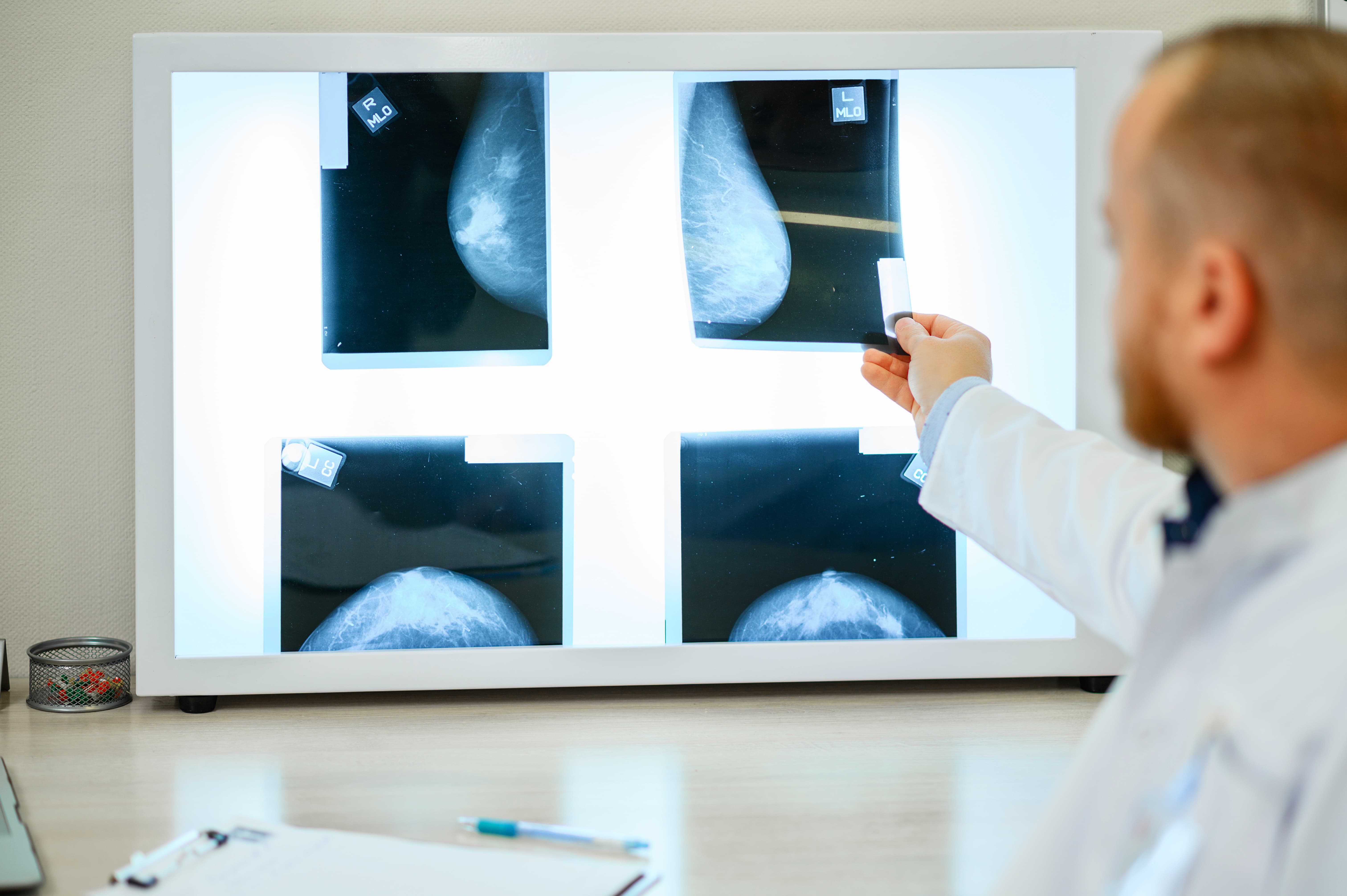 Medico specializzato in oncologia mentre esamina una lastra.