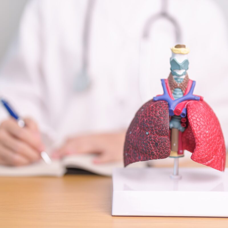 Medico specializzato in pneumologia con anatomia polmonare e differenza tra l'organo sano e quello di un fumatore.